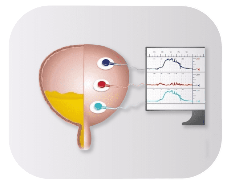 Estudo urodinâmico na Asa Sul | Dr. Gilvan Furtado
